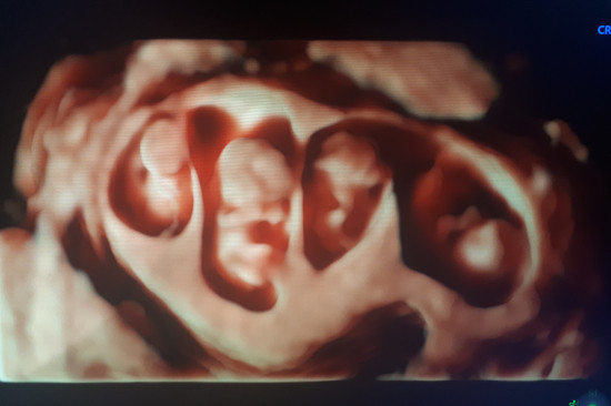 Prenatal counseling